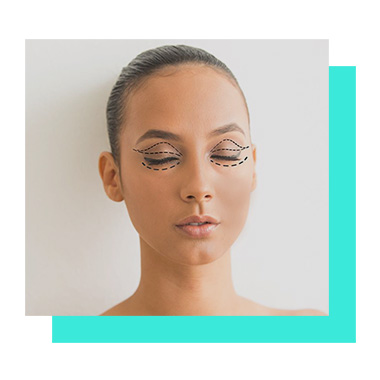 blefaroplastia-magic-plastic-center