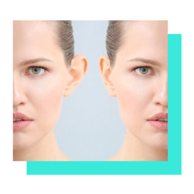 otoplastia-magic-plastic-center otoplastia-magic-plastic-center